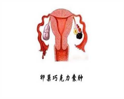 上海助孕的多少钱，上海助孕的多少钱？